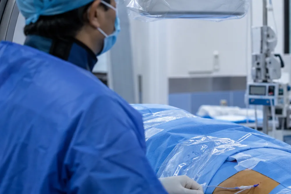 Quimioterapia intraperitoneal en Guatemala: tratamiento local para cáncer en cavidad abdominal